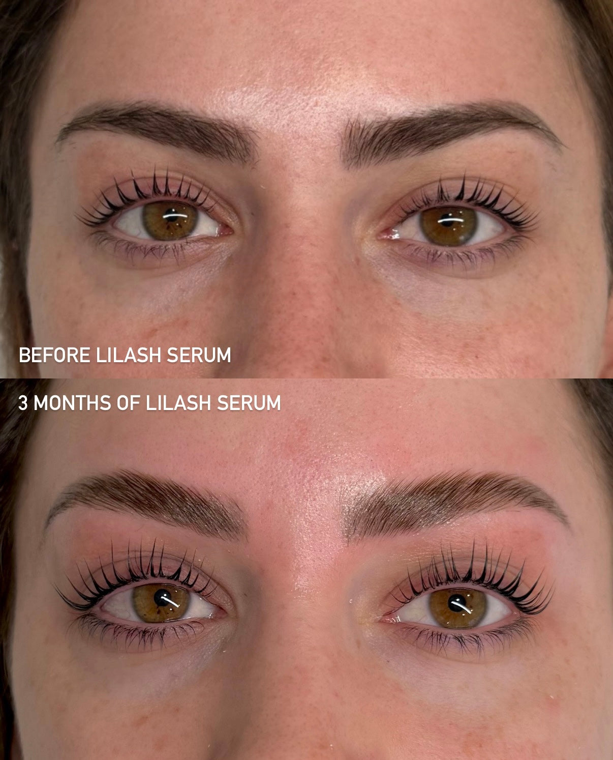 LILASH - EYELASH SERUM (2ml)